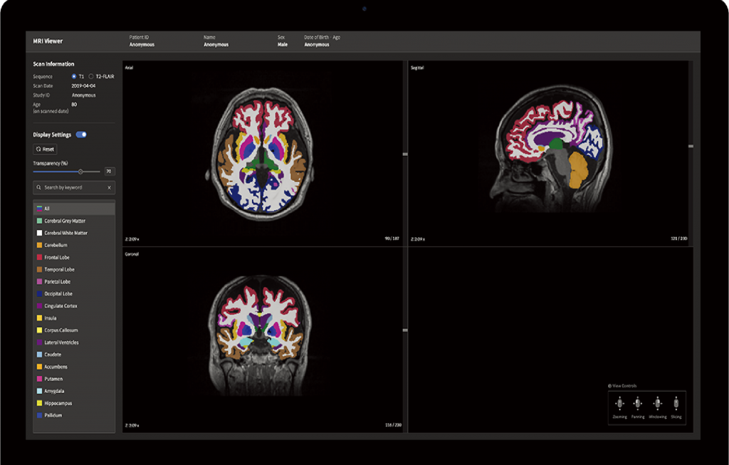 neurophet